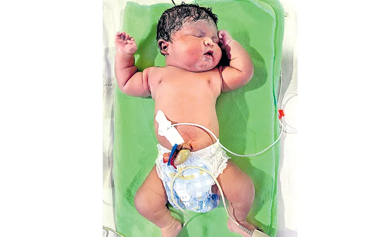 Woman gives birth to a boy weighing over five kilos