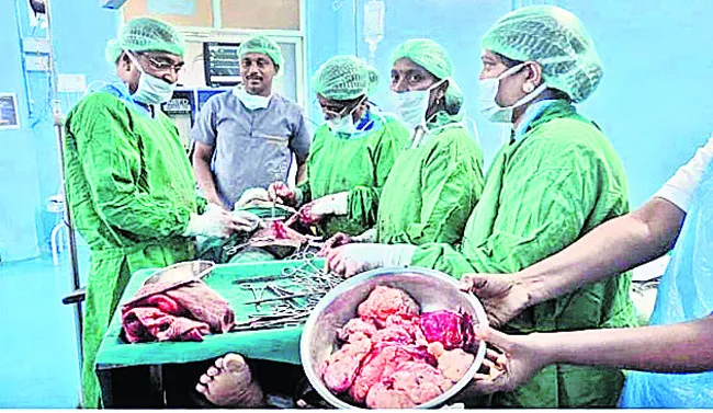 జిల్లా ఆస్పత్రిలో క్లిష్టమైన శస్త్రచికిత్స సక్సెస్‌