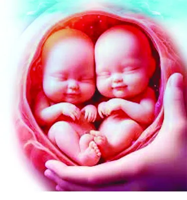 అచ్చం.. అలాగే! 