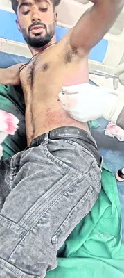 గ్యాంగ్‌ దాడుల్లో ఒకరికి కత్తి పోట్లు