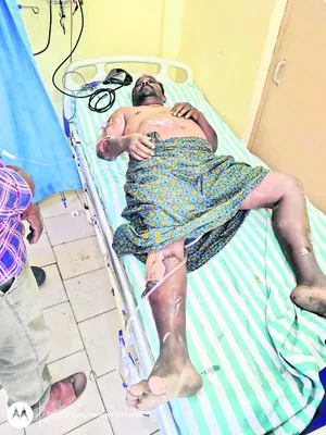 చెద మందు పిచికారీ చేస్తూ ప్రమాదం 