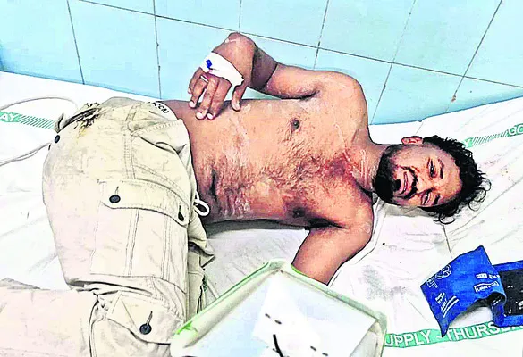 విద్యుదాఘాతంతో ఎలక్ట్రీషియన్‌కు తీవ్ర గాయాలు