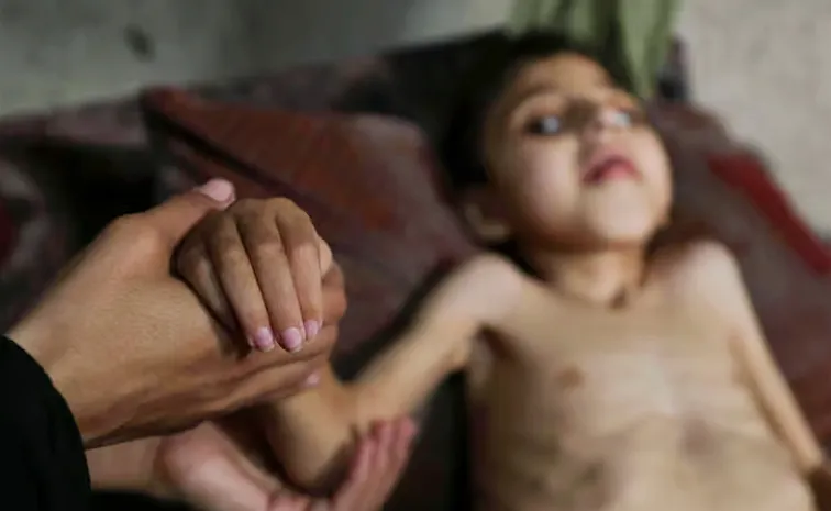 51 రోజుల్లో 11మంది అనాథ దివ్యాంగుల మృతి?