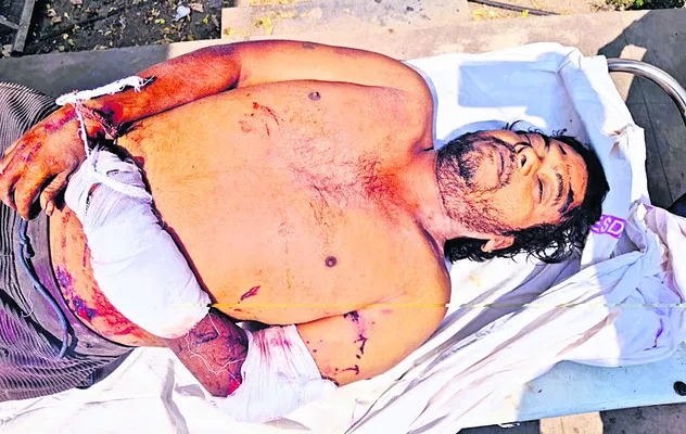 కారు ఢీ కొని వ్యక్తి మృతి 