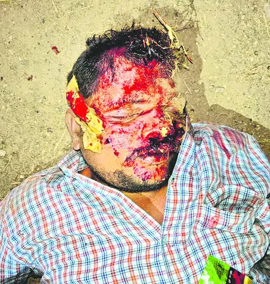 బైకు ప్రమాదంలో  యువకుడు మృతి 