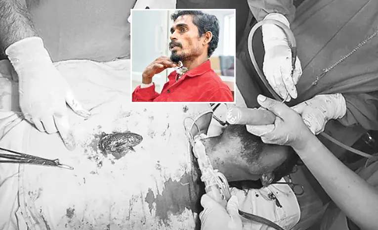 fish stuck in throat in Ongole