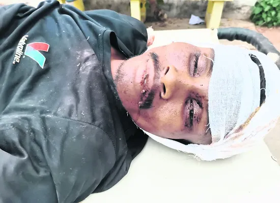 గుర్తుతెలియని వ్యక్తి దుర్మరణం