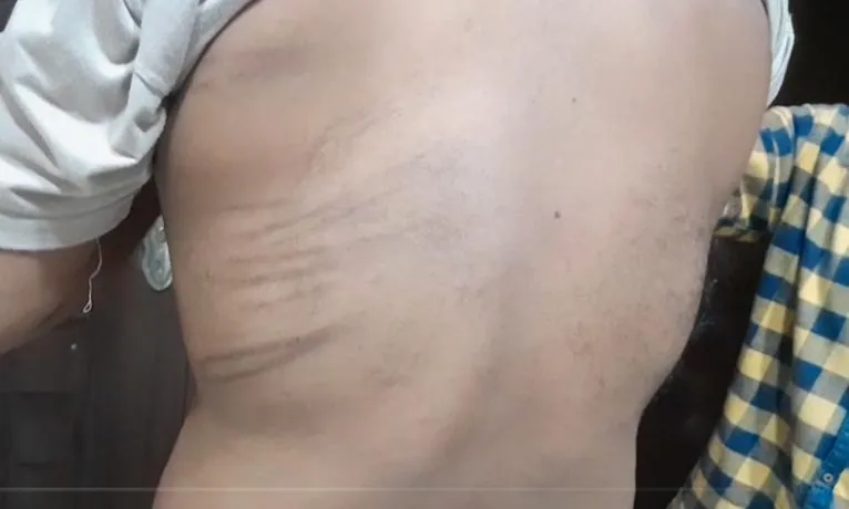 అనపర్తిలో ఆగని అధికార పార్టీ ఆగడాలు