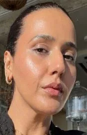 Weight Loss Helped This Dubai Woman Reverse PCOS to skin health