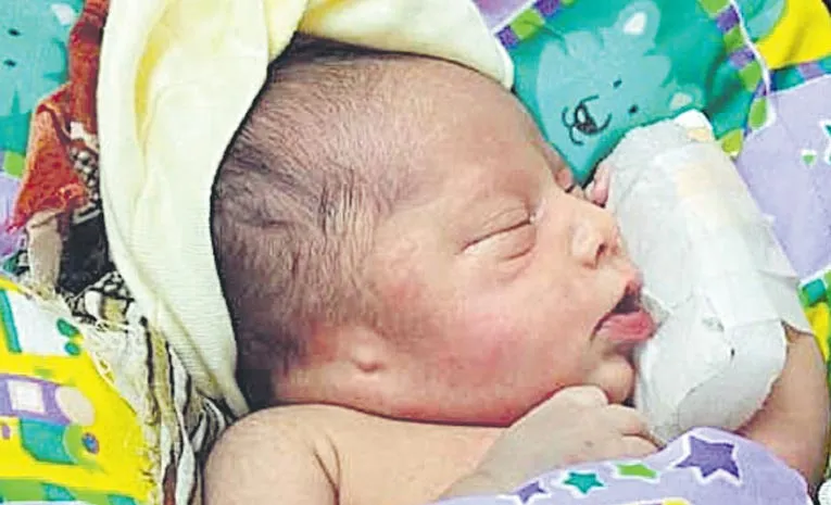 baby born without ears tanuku scan report controversy