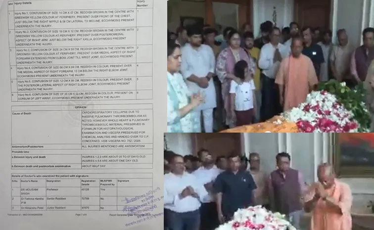 Prateek Yadav postmortem reveals he died due to blood clot in lungs