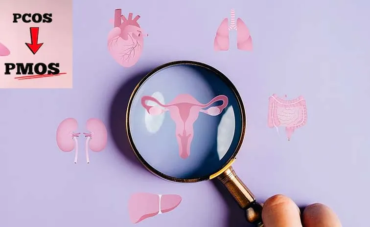 Health: PCOS Name Changed To PMOS