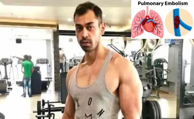 What is Massive Pulmonary Thromboembolism The Lung Clot Condition 