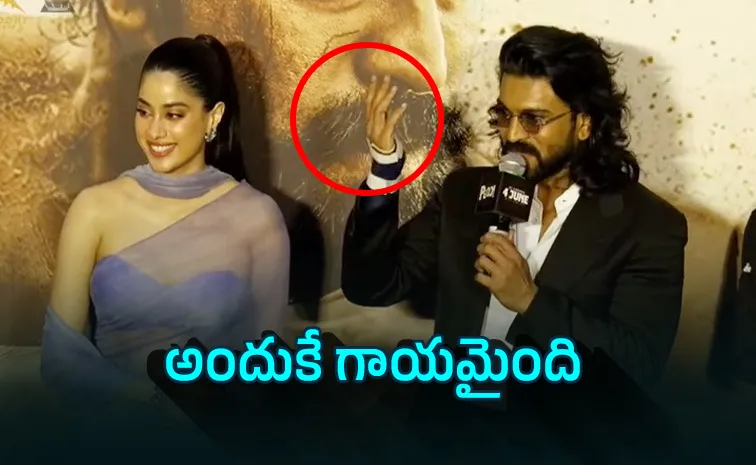 చేతికైన గాయం గురించి క్లారిటీ ఇచ్చిన చరణ్