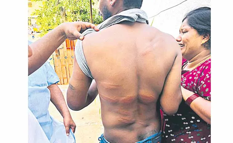 బ్యానర్‌ చించాడని యువకుడిపై థర్డ్‌ డిగ్రీ