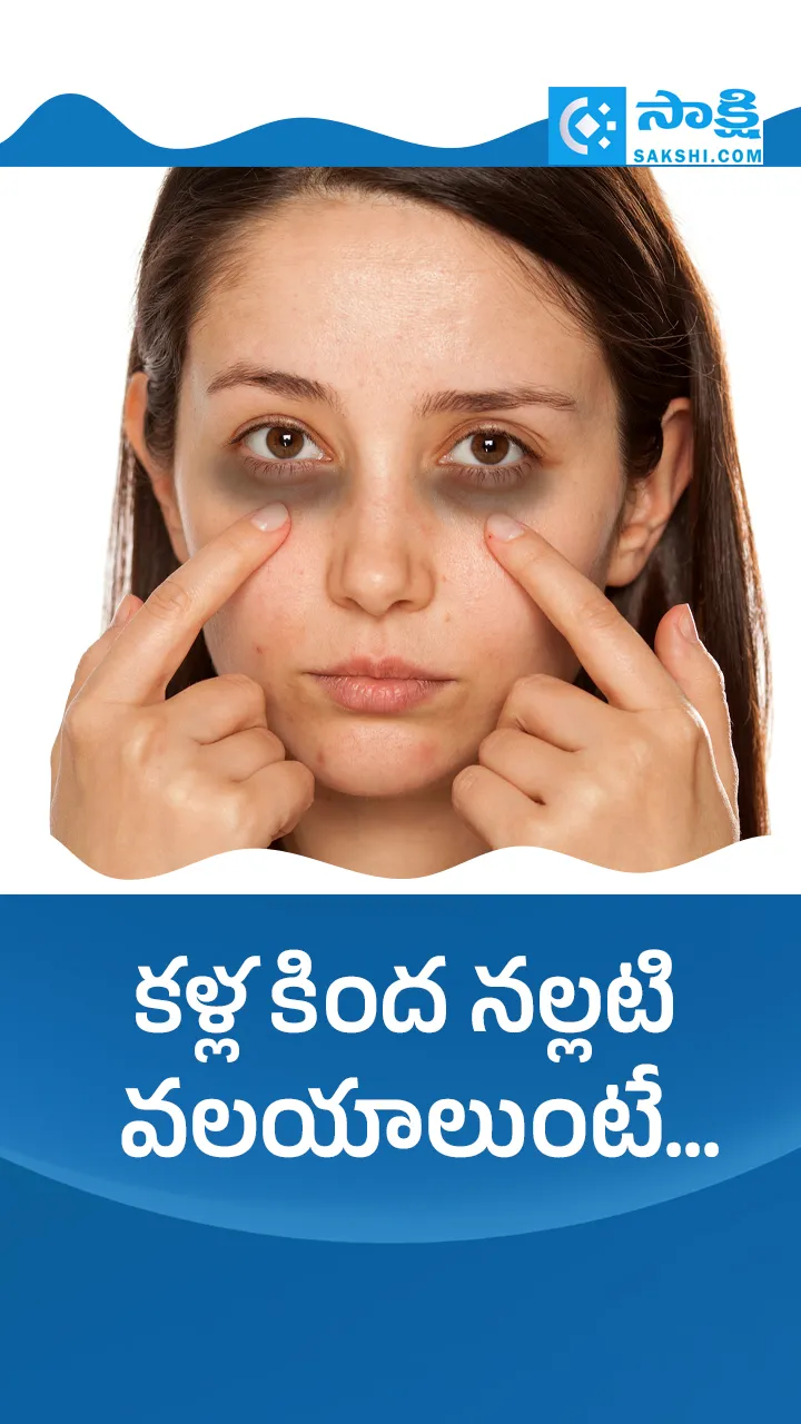 How to Remove Dark Circles Under Eyes Naturally: Easy Home Remedies