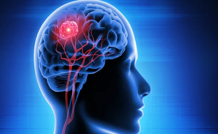World Brain Tumour Day 2026: Check how to Prevent and Aware