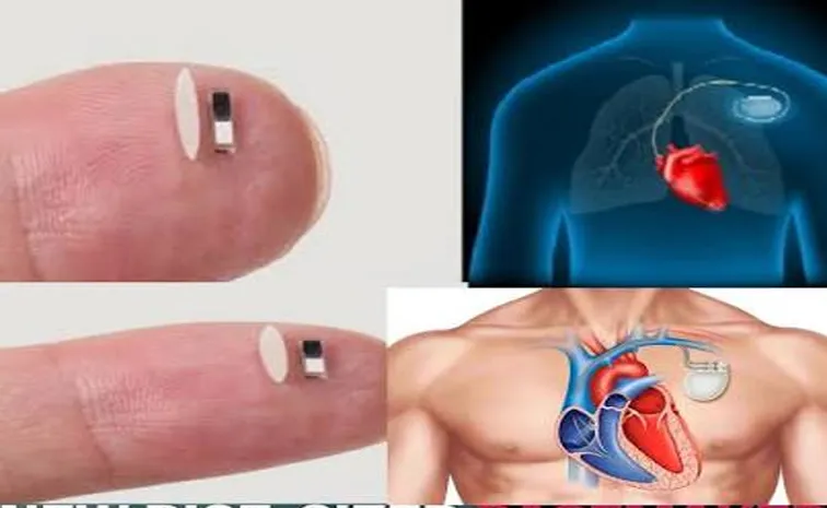 Wearable pacemaker uses ultrasound to control heart rhythm