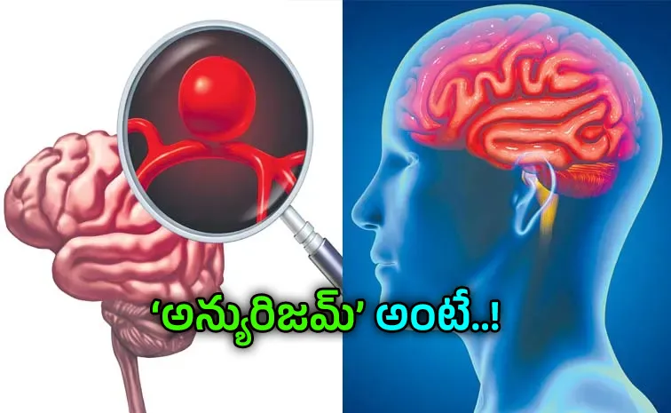 Brain Aneurysm Symptoms And Causes Health5