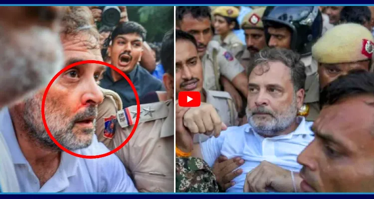రాహుల్ కి ముక్కు నుంచి రక్తస్రావం