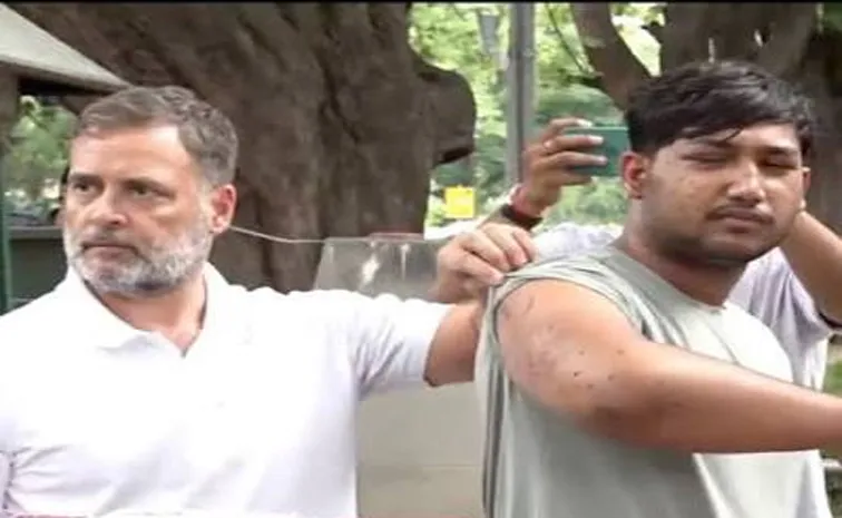Rahul Gandhi questioned who authorised th use of pellet guns, tear gas