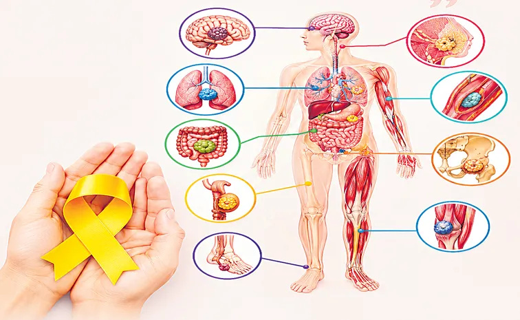 sarcoma is a rare type of malignant tumor