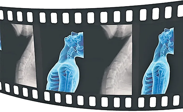 Explanation of Dynamic Digital Radiography