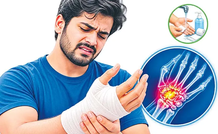 National Hand Surgery Day Hand Injuries First Aid Tips