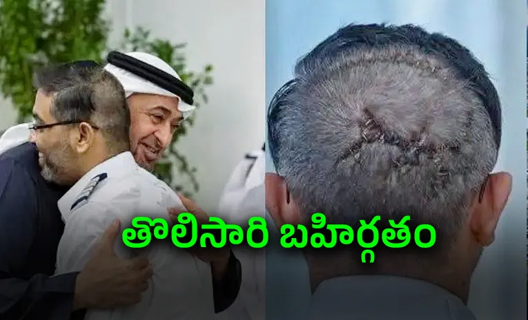 Pilot Smit Machchhars goes viral head injuries visible for first time