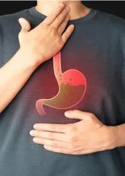 Health Tips: Heartburn: What It Feels Like Causes and Treatment
